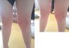 장애아동 활동보조인의 학대 정말 진실이 무엇인지 궁금합니다!!!