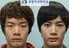 남자도성형해야하는구나ㅋㅋ(before&after)