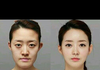 성형 사진ㅠ