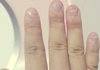 28년만에 고친 손톱버릇