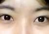눈꼬리가올라가서 스트레스받아요ㅠ