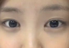 에이핑크 성형 어디서했음??