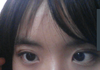 ㅠ제눈이 사시인가요?