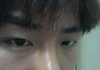 남자] 쌍수 유/무 어느게 낫죠??