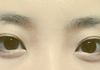 제 눈 좀 봐주세요... 수술한 것 같나요?
