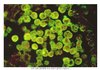 사람의 뇌를 파먹는 아메바