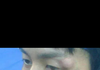 모기물린 광수ㅋㅋㅋㅋㅋㅋㅋㅋㅋㅋㅋㅋㅋㅋㅋㅋ