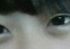 쌍수 헤야되나요ㅠㅠㅠㅠㅠㅠㅠ??