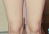 다리 좀 봐주세요
