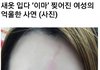 옷가게에서 새옷 입다 이마 찢어진 여성 ㄷㄷ