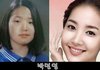 여자연예인 성형전...개충격(사진ㅇ)