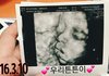 +주작아니야우리튼튼이맞아)나 임신했어 글쓰니인데