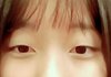 나 방금 갑자기 쌍꺼풀생김 ㅋㅋㅋㅋ