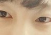 나 쌍수 필요한 눈인지 봐줘 ㅠㅠ