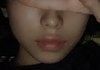 나 입술 졸 두꺼움