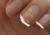 나는 손톱에 흰줄 징그러울 정도로 많음...