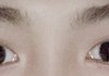 나 눈 몽고주름 심한 편이야??