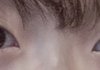 추가)) 이거 냅두면 쌍커풀 생겨...?ㅠㅠ