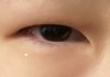 눈 성형 진짜 하고싶어.. 봐줘..