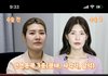 안면윤곽 ㅈㄴ 뿜뿌온다