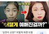 치과의사들이 말하는 김연아의 치아교정