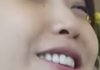 아이유 라미네이트 한거임??