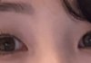 나 안검하수 있어보여?