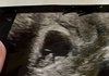 낙태수술날인데 고기썰어야된다고,,, 낙태수술보다 가게가 더 중요하다는데 망하게하는법 없을까요?ㅜ