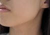 여드름주의) 10키로 턱선 차이 보여줌