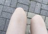 나 다리에 멍 어떡하냐...???