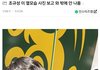 코 성형 왠만하면 하지마..