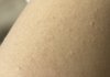 약혐)팔에 이거 뭐임?ㅜㅠㅠ