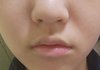 중딩 입술 평가좀..ㅠㅠ