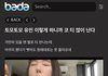 여기 토모토모 유인 성형한거 얘기하던데