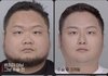 유튜버 렉카 구제역 성형 전후