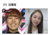 '치아교정을 성형처럼' 한국 연예인들