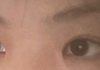 쌍수한거 티나?