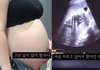 36주 낙태 유튜브 영상, '사실'… 유튜버 및 집도의 살인혐의 입건