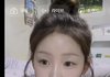 이분 쌍수 붓기 빠지면 ㄱㅊ을거같음?