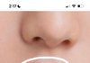 아토피 있는 애들 있음? 이거 아토피임?