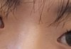 쌍수하면 어떨거같음?