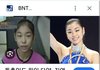 치아교정으로 미인형 얼굴로 180도 변신한 김연아