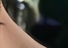코성형 한달차인데 붓기 언제 빠질까요?
