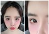 “눈 속 핏빛 번짐?” 박봄, 드라이브 중 근황에 팬들 ‘걱정 반 반가움 반’