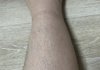 생리를 안하는데 다이어트가 답인걸까요?