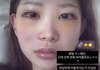 '故 최진실 딸' 최준희, 광대·눈 성형에 흰자까지 부었는데…한 달만 놀라운 변화
