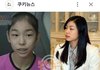 성형의혹  연예인