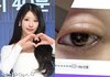 이미주, 안타까운 눈 상태…눈두덩이 모기 물렸다 [해시태그]