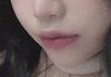 나 입술 필러 대성공함 !!!