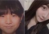 성형으로 눈이 일케 커질수있는거임??